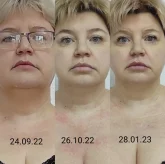 Кабинет косметологии и массажа Елены Ганзюк фото 6